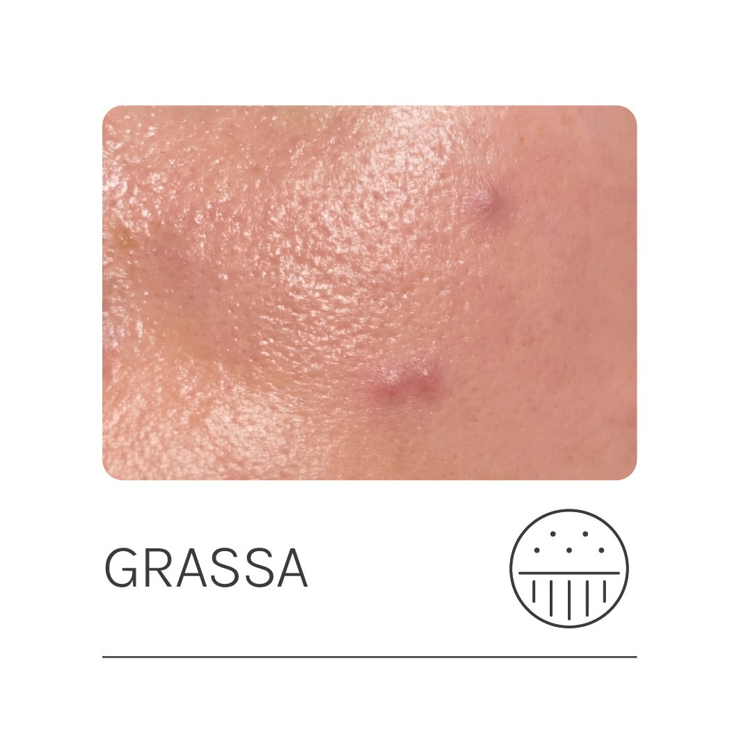 Pelle grassa, mista